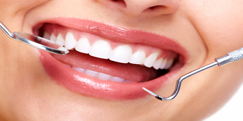 Preventative Treatments at PERFECT SMILE